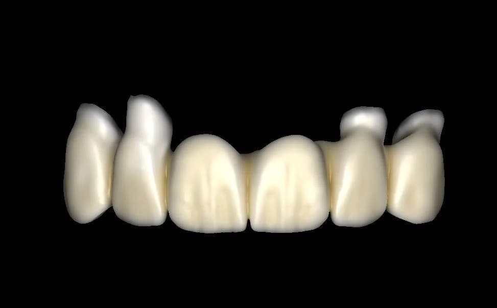 اگزو کد چیست؟ معرفی کامل نرمافزار طراحی دندانپزشکی